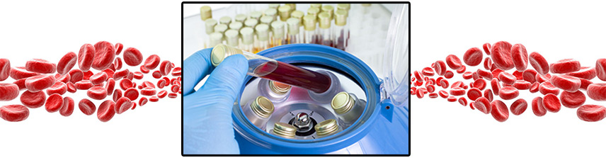 Blood Platelets (PRP) Expand Cash- Based Regenerative Medical Options
